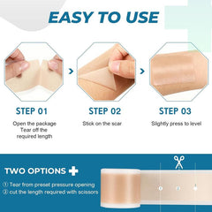 Professional Silicone Scar Sheets (1.6" x 120" Scar Roll-3M) - Scars Removal Treatment - Reusable Silicone Scar Tape Strips Type for Keloid, C-Section, Surgery, Burn, Acne et