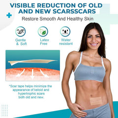 Professional Silicone Scar Sheets (1.6" x 120" Scar Roll-3M) - Scars Removal Treatment - Reusable Silicone Scar Tape Strips Type for Keloid, C-Section, Surgery, Burn, Acne et