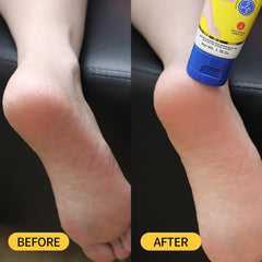 Aavini Intense Foot Cream - Repairs Cracked Skin, Antibacterial and Deodorizing, Removes and Softens Calluses, For All Skin Types, Moisturizing Foot Lotion