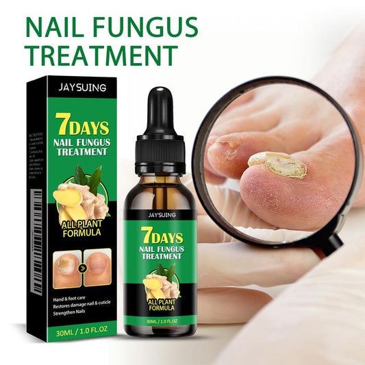 Ginger Nail Treatment Nail Support Nail Care 800