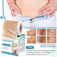 Professional Silicone Scar Sheets (1.6" x 120" Scar Roll-3M) - Scars Removal Treatment - Reusable Silicone Scar Tape Strips Type for Keloid, C-Section, Surgery, Burn, Acne et