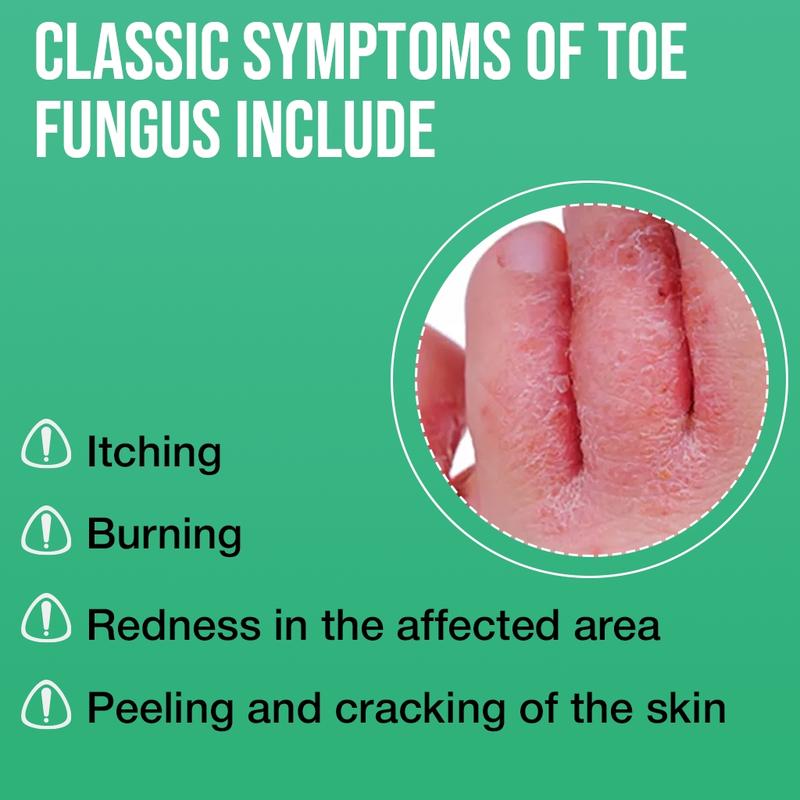 Tea Tree Oil Foot Sanitizer Spray for Dry Cracked Feet, Nail Fungus, Jock Itch, Ringworm, Cracked Heels, and Itchy Skin | Foot Spray