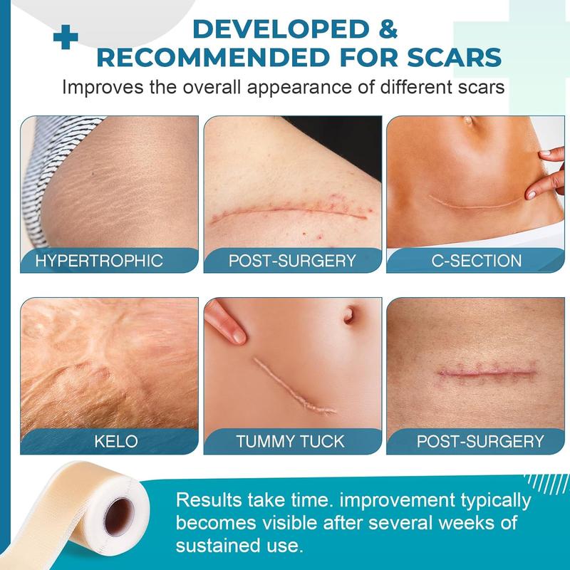 Professional Silicone Scar Sheets (1.6" x 120" Scar Roll-3M) - Scars Removal Treatment - Reusable Silicone Scar Tape Strips Type for Keloid, C-Section, Surgery, Burn, Acne et
